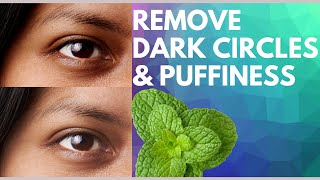 How to get rid of dark circles and eye bags in less than 30 mins