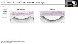 2022 10 04 Lecture 9 Clinical use of OCT attenuation coefficients