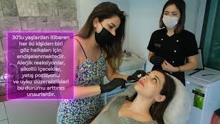 Gözaltı Işık Dolgusu | Uzm. Dr. Dilek Destegül