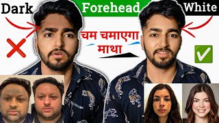 Black Forehead Treatment | Black Forehead to White Forehead | Sahil Nagpal