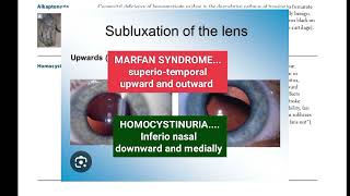 homocysteinuria page84|first aid USMLE|Fcps part-1 preparation|cpsp favourite questions