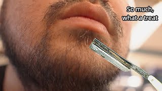 💈ASMR | Remove a lot of beard from a man's face. 🪒 Master shave for 20 years younger !