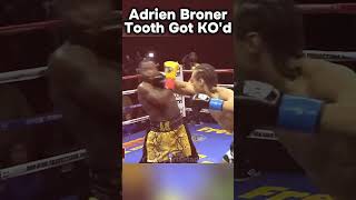 Adrien "The Problem" Broner needs a Dentist after this fight