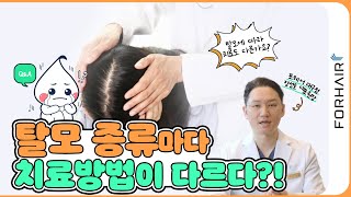 내 탈모에 맞는 치료법은?ㅣ포헤어 대구