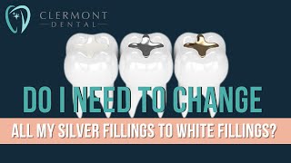 Do I Need To Change All My Silver Fillings To White Fillings?