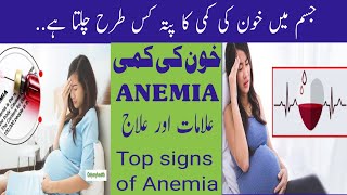 khoon ki kami ka kisTarah pata chalta hai?Top symptoms of Anemia! Anemia kya hota h in Urdu hindi!!