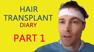 My Hair Transplant Diary - part 1