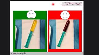 VT Ablation In Patients With non ischemic heart disease   Dr Noureddin Sawan