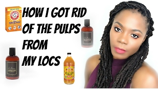 Update to How I Got Rid of the Pulps From My Locs/Jungle Barbie