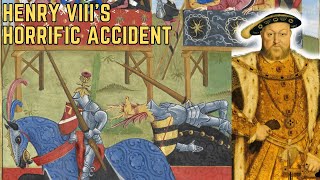 The Accident That Almost Killed Henry VIII