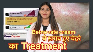 Betnovate c steroid creams side effects | लाल चेहरे का ट्रीटमेण्ट ।