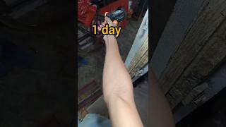 hand gripper|| hand gripper before and after||hand gripper transformation