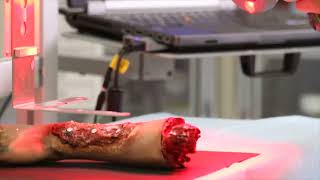 Wake Forest Institute for Regenerative Medicine (WFIRM) - mobile skin bioprinting system