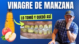 Así quedó después de tomar Vinagre de Manzana por un año