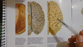 CEREBRUM OF BRAIN II SNELL CLINICAL ANATOMY II