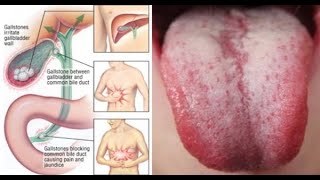 10 Warning Symptoms To Remind You It’s Time to Flush Toxin Out of Your Body!