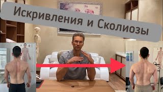 Как исправить осанку. Лечение сколиоза.