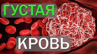 Густая кровь / Когда начинать пить АСПИРИН ?