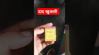 #ringcutter ointment use in Hindi #daad #khujlikailaj #skincare #skin @DrAkeel603