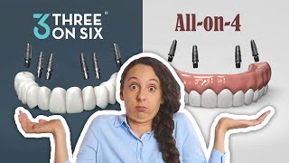 All-on-4 VS 3 on 6™ Smile Restoration