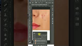 Face pimple cleaning in Photoshop | Photoshop hacks#shorts