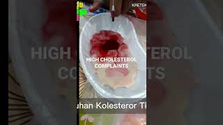 Treatment For High Cholesterol  #shorts #fyp #kesehatan #health #amazing #world