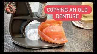 COPYING AN OLD DENTURE MEASUREMENTS (ALMA GUAGE)طريقة قياس ابعاد الدينجر القديم واستعمالها في الجديد