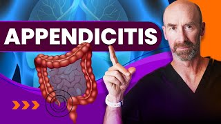 Appendicitis:  When SHOULD I Go To The Doctor?