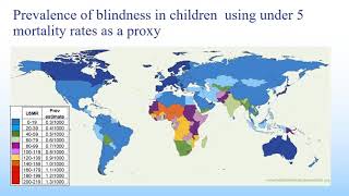 IPOSC-SBOP joint webinar :Pediatlic Low Vision, November 28th, 2021