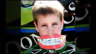 Smile on a Stick - Flowery Branch Orthodontics