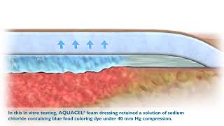 Aquacel Foam