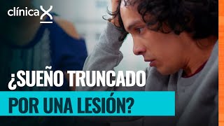 El extremo dolor y el aspecto de su pierna no son nada alentadores | Clínica X