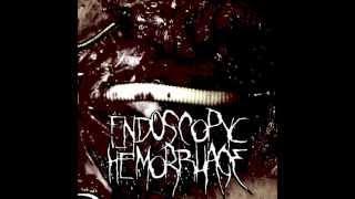 Endoscopyc Hemorrhage - Bizarre Thoughts Horrificly Conceived (alternate version)