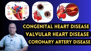 Congenital Heart Disease | Valvular Heart Disease | Coronary Artery Disease को संक्षिप्त में जानें