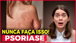 PSORÍASE: CONHECIMENTO É A CHAVE PARA UMA VIDA MELHOR