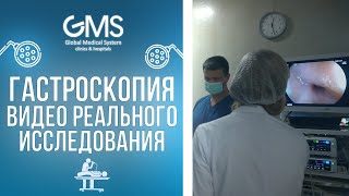 ГАСТРОСКОПИЯ. ПРОВЕДЕНИЕ ПРОЦЕДУРЫ. РЕАЛЬНОЕ ИССЛЕДОВАНИЕ