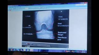 radiological anatomy of knee joint