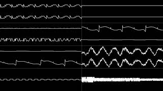 Sonic the Hedgehog 3 (1993 Prototype) - "Knuckles' Theme" [Oscilloscope View]