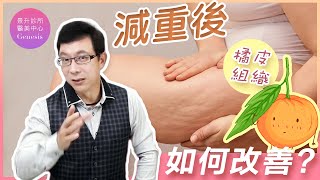 【邱醫來了ep.125】減肥後橘皮組織猖獗？橘皮組織困擾你多時？這些改善方法讓你重拾美腿自信！ft.脂肪專家邱正宏醫師