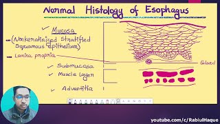 Tumors of the Esophagus (Part 01)