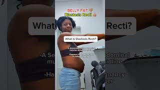 IS THIS BELLY FAT OR Diastasis Recti 🫠 #flattummy #flattummyworkout #shorts