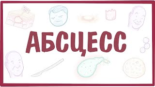 АБСЦЕСС — причины, симптомы, патогенез, диагностика, лечение