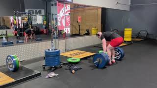 185kg / 407.8lbs x 12 Trap Bar Deadlifts with Fused Spine (L5-S1)