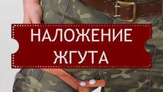 Наложение жгута