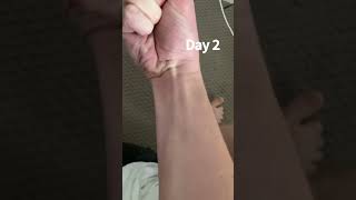 Day 2 of Handgrip transformation