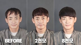 탈모인 한민관 2천모~1만모까지 헤어증모술 시술 리얼 후기 (탈모붙임머리, 블랭크유)