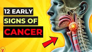 12 Warning Signs of CANCER Growing In Your Body You Shouldn't Ignore (Never Miss) | VisitJoy