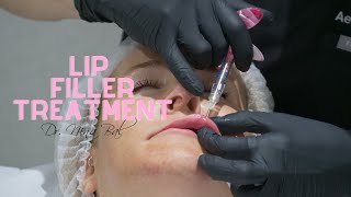 Lip Filler Before and After at the Facial Sculpting Clinic 💕 Lip Filler Injection by Dr Nina Bal