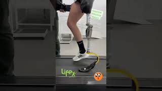 PRÓTESE ESPORTIVA PASO KNEE + FLEX RUN ÖSSUR