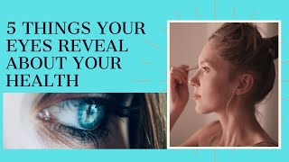 5 Things your Eyes reveal about your Health